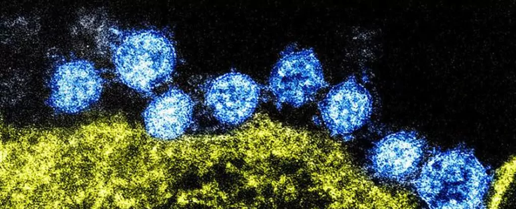 Cum rupe epidemia de coronavirus lanțurile alimentare internaționale